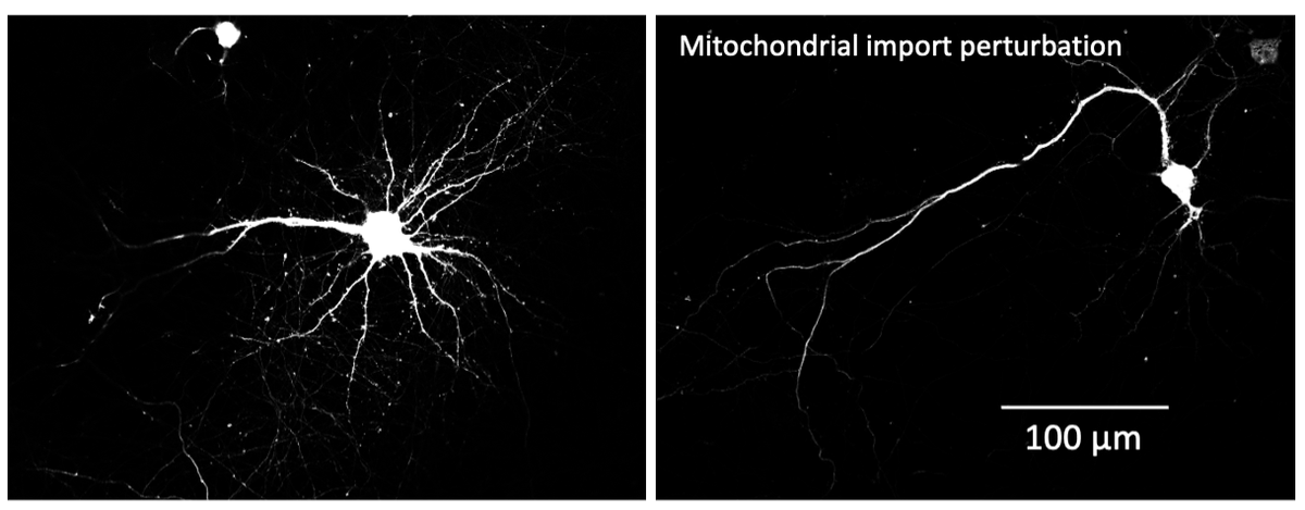 Ian Collinson (@ianofbristol) on Twitter photo Mess with the mitochondrial import machinery in neurones (including by disease-linked Tau) then this happens.....
Another <a href="/hopeneeds/">Hope Isobel Needs</a> (<a href="/BristolBiochem/">Bristol Biochemistry</a> <a href="/LabCollinson/">Collinson Lab</a> ) paper with the Henley lab. As ever thanks to our amazing funders <a href="/wellcometrust/">Wellcome</a>
biorxiv.org/content/10.110… Mess with the mitochondrial import machinery in neurones (including by disease-linked Tau) then this happens.....
Another <a href="/hopeneeds/">Hope Isobel Needs</a> (<a href="/BristolBiochem/">Bristol Biochemistry</a> <a href="/LabCollinson/">Collinson Lab</a> ) paper with the Henley lab. As ever thanks to our amazing funders <a href="/wellcometrust/">Wellcome</a>
biorxiv.org/content/10.110…