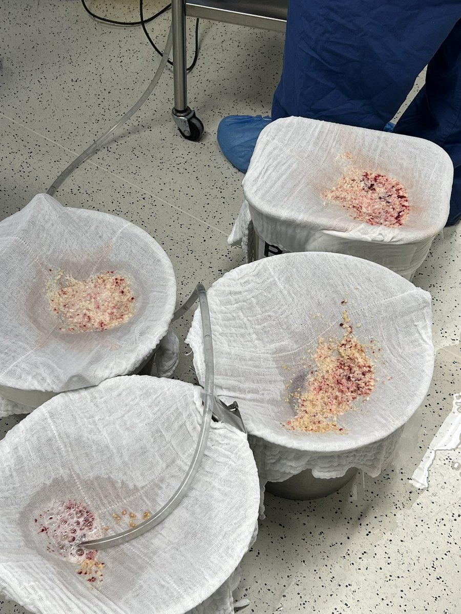 MD Braulio O. Manzo tweet media