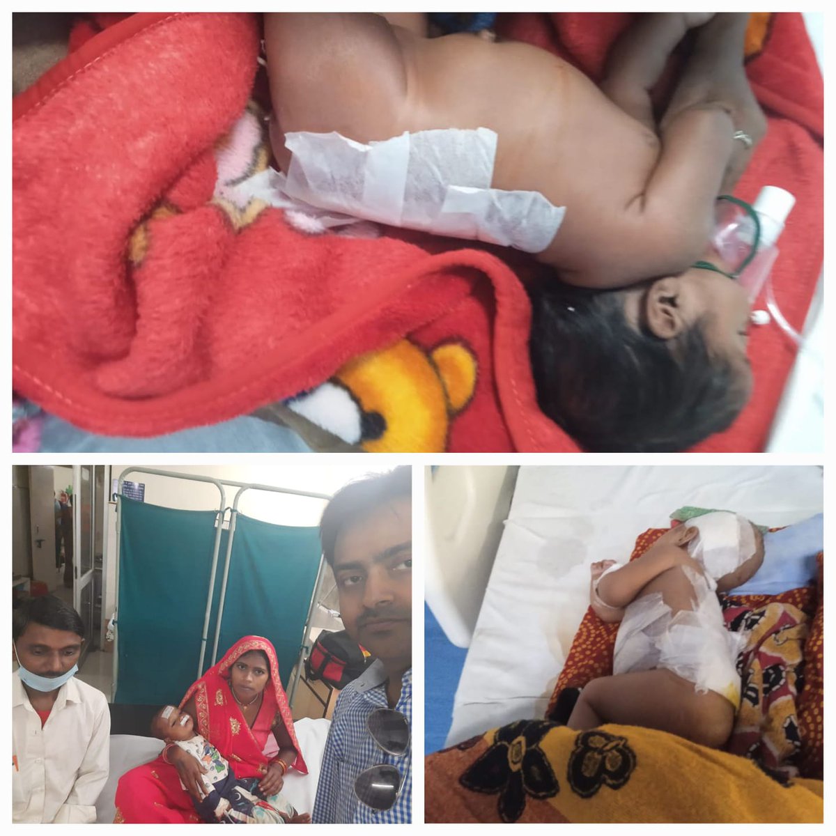 #राष्ट्रीय_बाल_स्वास्थ्य_कार्यक्रम से जन्मजात दोष से ग्रसित बच्चों को मिल रही है जीवन की नई किरण । न्यूरल ट्यूब डिफेक्ट से ग्रसित बेबी श्रुति और कार्तिक की #RBSK कार्यक्रम के अंतर्गत झांसी मेडिकल कॉलेज मे कराई गई निःशुल्क सर्जरी l
#स्वास्थ्यविभागउत्तरप्रदेश
<a href="/brajeshpathakup/">Brajesh Pathak</a>