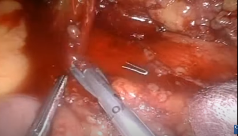 Colorectal Disease tweet media