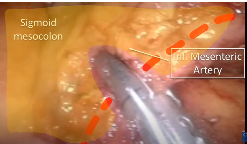 Colorectal Disease tweet media