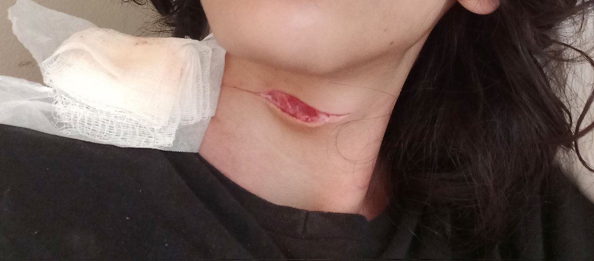 souolipee's tweet photo. Beans no pescoço #sh #selfharm #beansselfharm https://t.co/2Z3vbzyeQV