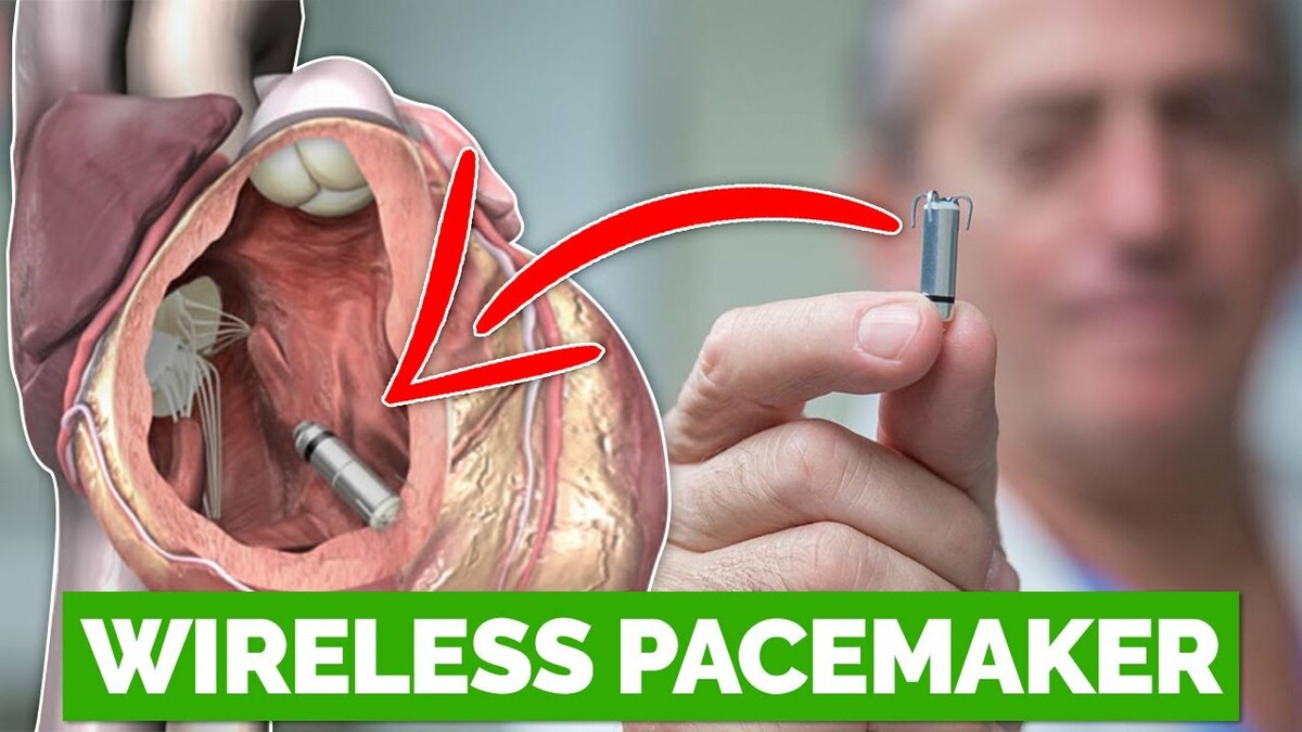 HeartScopeCare's tweet photo. Hello there,

Welcome to Scope-Care!!!

Experimental Wireless Pacemaker Dissolves When No Longer Needed

To know more about this please visit our YouTube channel: https://t.co/2czpV2fTCo

Visit our website: https://t.co/YEYwfoquVv

#hearthealth #health #heart #healthylifestyle https://t.co/NMxemnpzAg