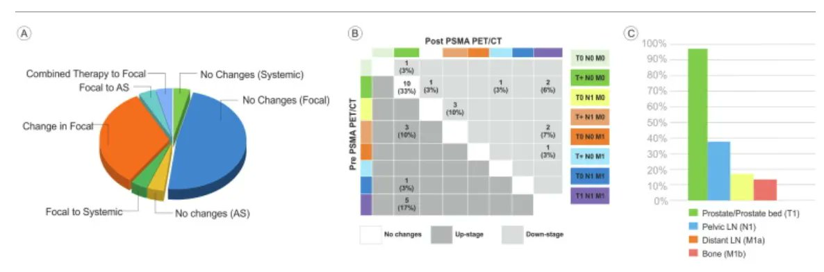 EUplatinum's tweet photo. Incorporating PSMA PET in Management Decisions for Men with Newly Diagnosed or Biochemically Recurrent Prostate Cancer 

https://t.co/52K7hr9Slq 

@LauraBukavinaMD @AmyLuckenbaugh @DrMHofman @sophia_kamran @declangmurphy @KOSJ12 @piet_ost https://t.co/0sPSRmxh6M