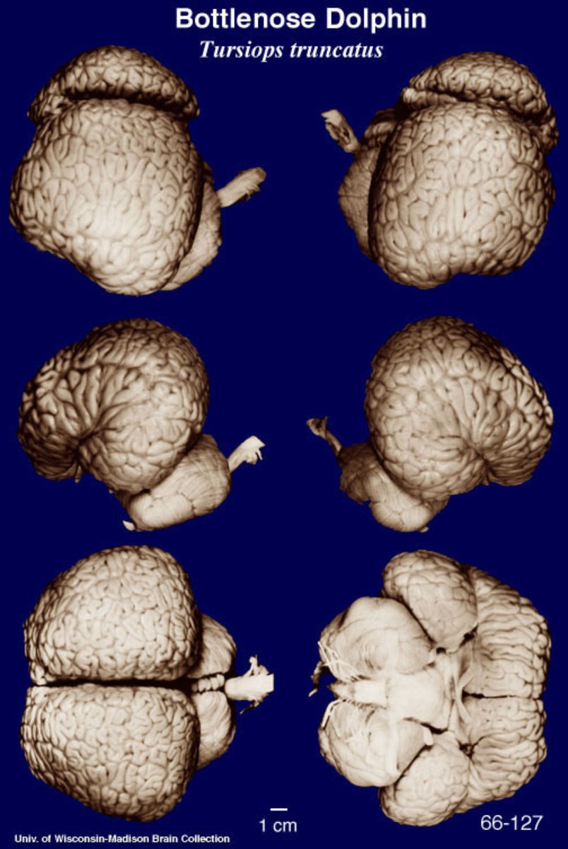 Головной мозг дельфина строение. Мозг дельфина и человека. Мозг дельфина и человека. Сколько у дельфинов мозга. Строение мозга дельфина.