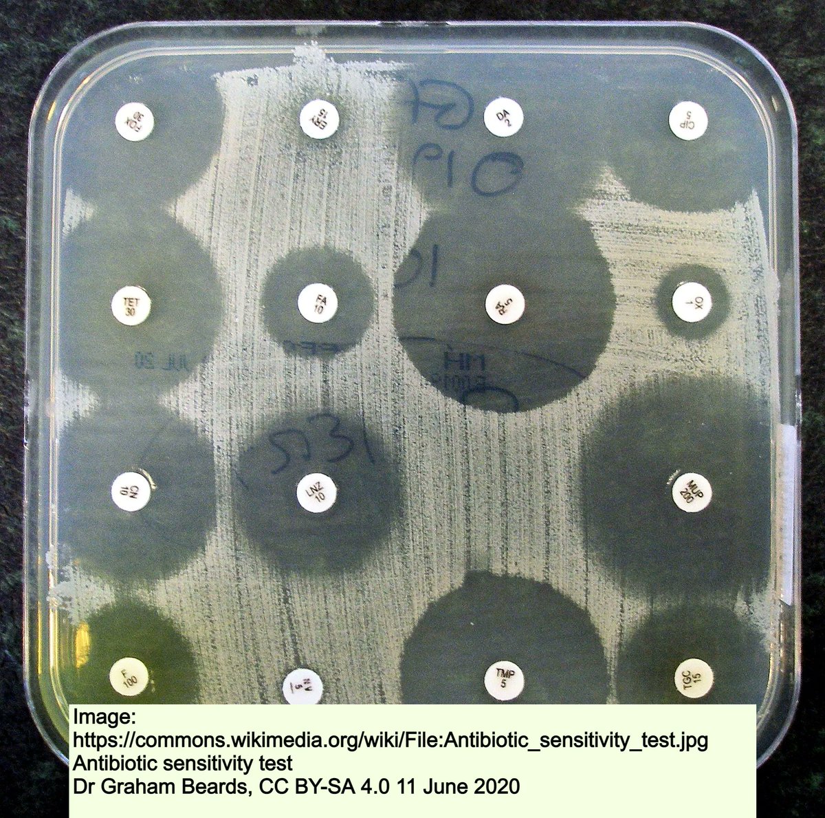 DocAliceWrites's tweet image. Resistance is futile! 
Drugs that once killed germs are losing potency. In 2019 #AntimicrobialResistance directly caused the deaths of 1.3m people worldwide–more than HIV/AIDS or malaria alone.
Fast facts here: buff.ly/3FTKwt2 

#WAAW2022 @CDCgov @NaturePortfolio @ACSQHC