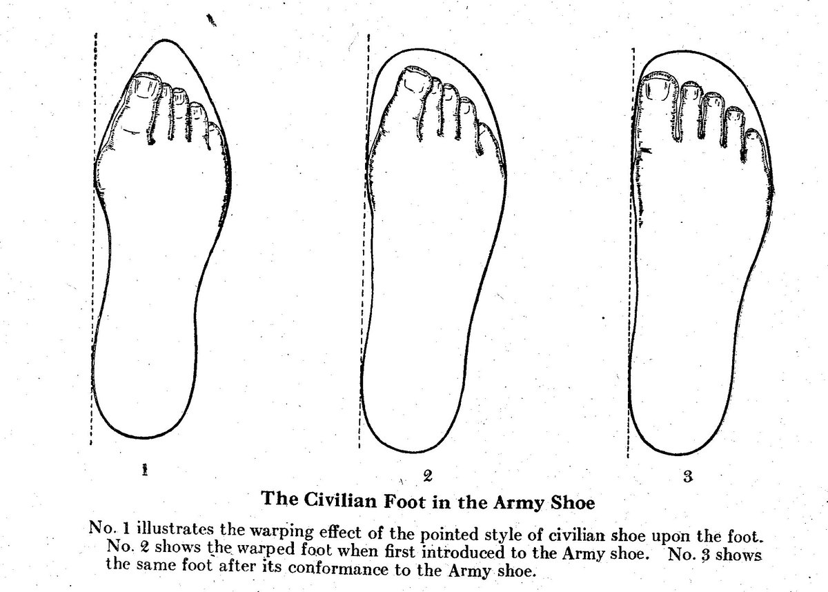 Around 1927 a new XRay powered device known as a shoe fitting