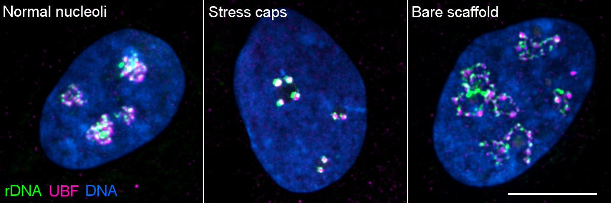 Our new preprint on nucleolar stress caused by anticancer drugs with <a href="/unruhjay/">Jay Unruh</a>,  <a href="/JulieConkright/">Julie Conkright-Fincham, PhD</a> , Charles Banks, David Schneider, <a href="/LaurenceFlorens/">Laurence Florens</a> and  <a href="/GertonJennifer/">Jennifer Gerton</a> is up. 
biorxiv.org/cgi/content/sh…  
🧵