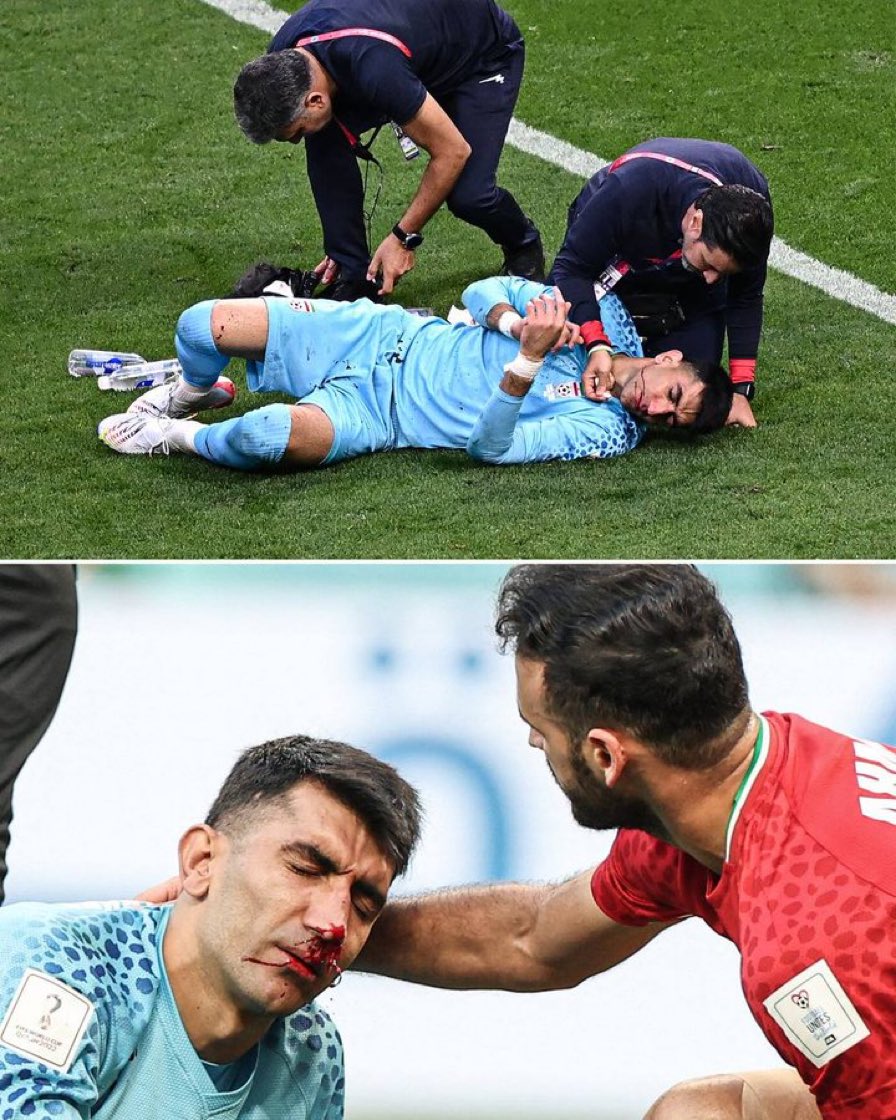 ChrisNowinski1's tweet image. Iran&apos;s goalkeeper went down after clashing heads w/teammate. Cleared, only to lay down minutes later &amp;amp; beg for a sub.
#WorldCup is off to a disastrous start on #concussion management. 
Sets an example that puts 10&apos;s of millions of global youth players at risk.
Shameful.