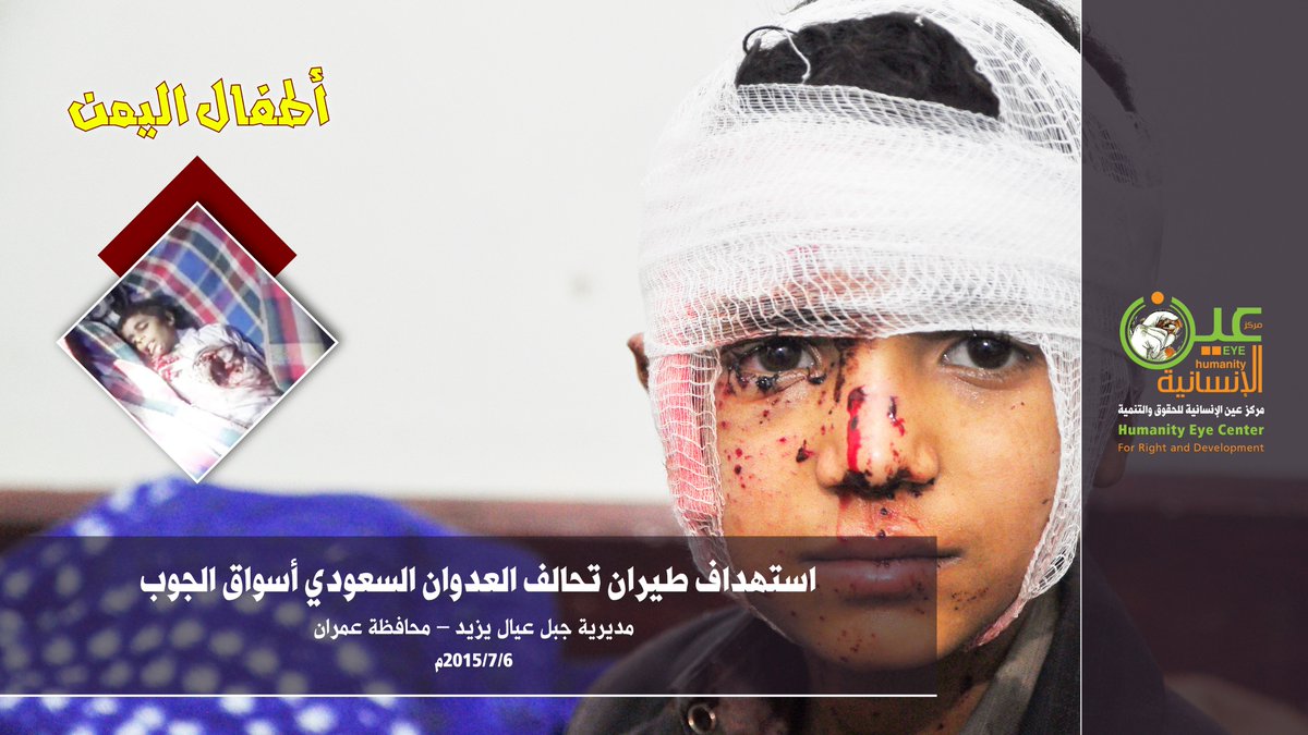 Yemen_020's tweet photo. ما الذي هدم صروح الفطرة الإنسانية وأحرق مبادئها 
النقية وأنتهك عرض أخلاقها السامية ؟ 

ما الذي جعل العالم لا تنصت مشاعره إلى مظلومية أطفال 
اليمن رغم المجازر اليومية التي تذيب الصخور الصماء؟ 

https://t.co/FhYX3Bahib
#WorldChildrensDay
#اليوم_العالمي_للطفل
