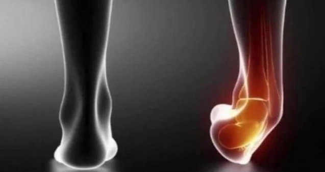 Nadie:
Mi tobillo sin motivo alguno cuando ando por la calle: