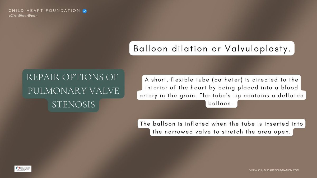 ChildHeartFndn's tweet photo. Mild pulmonary stenosis often does not require treatment. Moderate or severe stenosis is treated with the repair of the obstructed valve. Several options are currently available. #chd #chdaware #emergency #pvs #heartsurgery #catheter #ballon #valvuloplasty #heartdefects #heart 🧵 https://t.co/8QHu3QRIbL