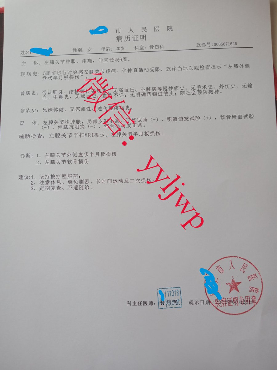 yyljwp2's tweet photo. 病史摘要患者，女，37岁，因“发现乳腺肿块一周”入院。2年前曾患领下腺癌，行多次放化疗，现影像检查发现双侧乳腺多发致密区，肝脏及腹膜后多发实性低回声区。
大体所见: 送检粗针穿刺标本2份(肿物1、肿物2)，大小分别约2x1.5x0.5cm及2x1x0.5cm，灰白、质硬:诊断结果: 转移性低分���癌。#病例 https://t.co/EAqUWGOA2f