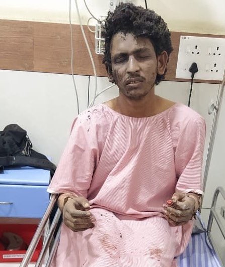 shubhankrmishra's tweet photo. कुकर बम से मंगलुरु शहर दहलाने निकला संदिग्ध आतंकी, पहले ही फट गया, खुद हो गया शिकार। 

- अगर इस कुकर बम को लोकेशन तक पहुंचाने में कायम हो जाता तो भयानक तबाही वाला विस्फोट हो सकता था। 
- आरोपी शारिक के ISIS से संबंध थे।
- प्रेम राज का आधार कार्ड लेकर सफर कर रहा शारिक। https://t.co/TARo5QICRr