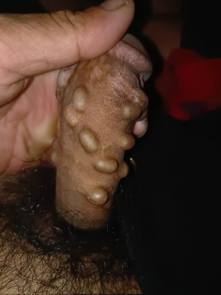 CopDem94's tweet photo. Nhìn nổi hết da gà da zịt. 🤬🤬🤬 https://t.co/OM3X0eqlVB