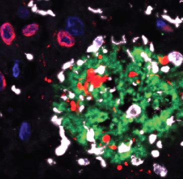 Butovsky Lab is looking for a Bioinformatician.

We are studying microglia-immune interactions in Alzheimer’s disease. Bachelors required. MSc or PhD in Computer Science, Mathematics in a biological science or relevant field recommended: dropbox.com/s/jirxn0zt3zlh…