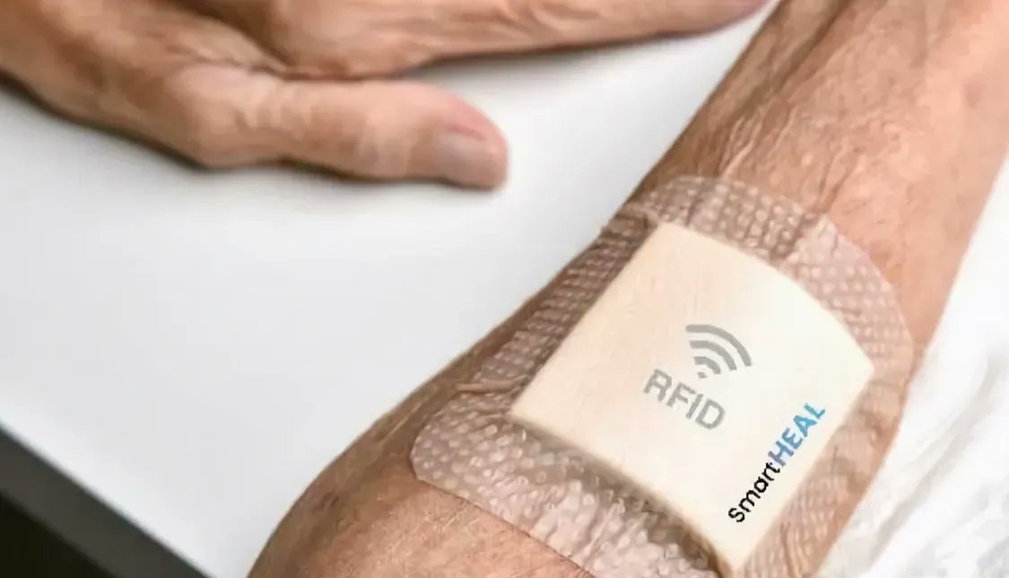 FlashTweet's tweet photo. 4️⃣ [ACCÉLÉRER]
#SmartHEAL, le pansement connecté qui évalue l’état de la plaie https://t.co/71HlysEQZa v/ @journaldugeek
 
⚡️Le projet a obtenu le prix Dyson pour son pansement avec capteur de PH et système de communication RFID

#FrenchTech #HealthTech 
#FlashTweet https://t.co/TS5aMzNhgQ