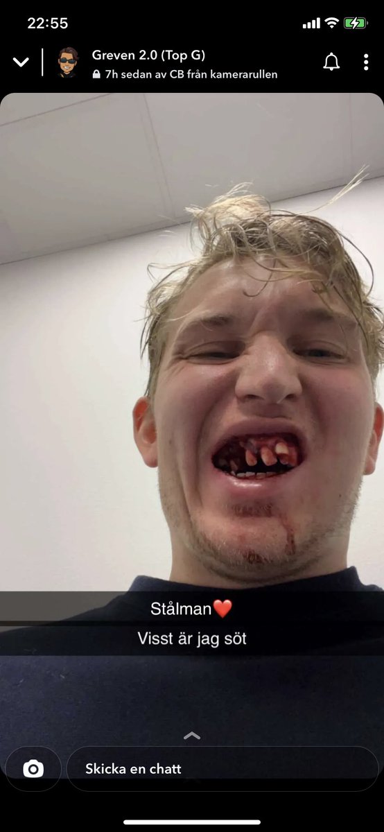 williamjosbrant's tweet image. Ajja måndag igen #krya @ville_erixon