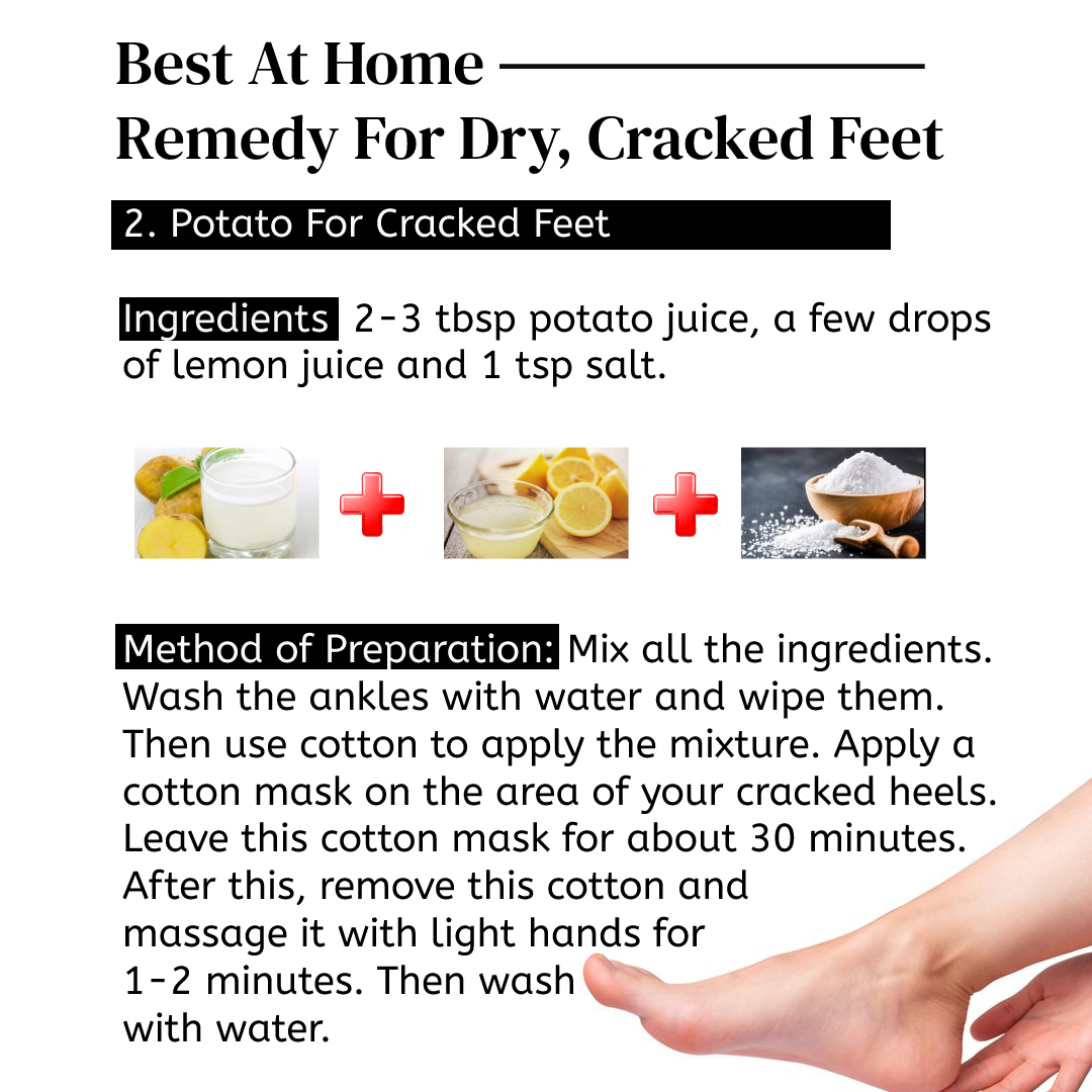 3 Home Remedies To Treat Severe Painful Dry Cracked Heels! - Wildturmeric