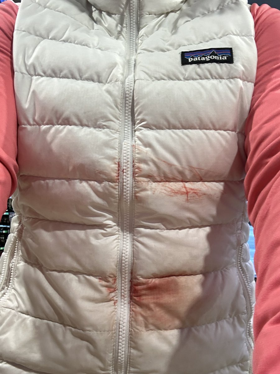 coxswainslog's tweet photo. 🩸 Bloody Bow Alert 🚨 No clue when and how this happened but had a good row bowing a 4x with the juniors varsity boys coach in my boat’s 2-seat rowing with the open women team for the first time. Okay, gotta go wash the vest! #RowingReport https://t.co/IzhEU5lNXE