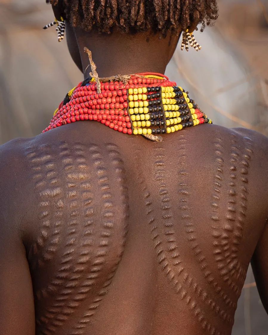 Avoir des cicatrices est encore de tradition dans certaines régions du monde.
📷: Références à la tribu Dassanech. Éthiopie
