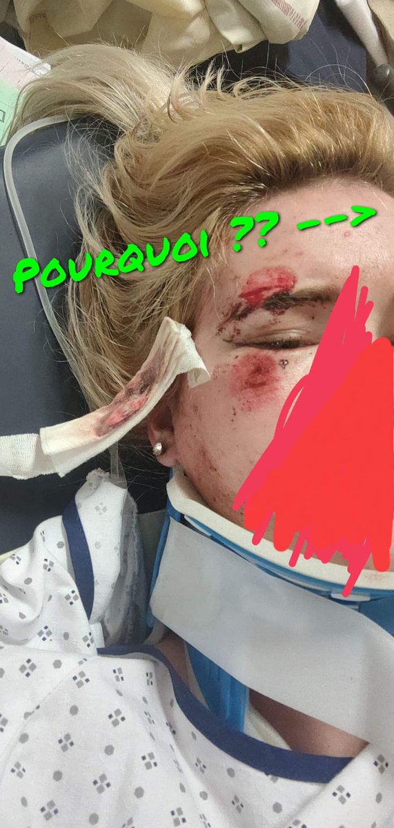 ScheffenC's tweet photo. En rentrant du travail, Sara, 21 ans, a été percutée le 12/11 vers 21h à Nantes par une voiture grise. Le conducteur, brun, peau mate, d'environ 25 ans a accéléré et foncé sur elle.

Projetée 13 mètres plus loin, elle est laissée pour morte, en sang et incapable de bouger. https://t.co/pUIPvmxtGM