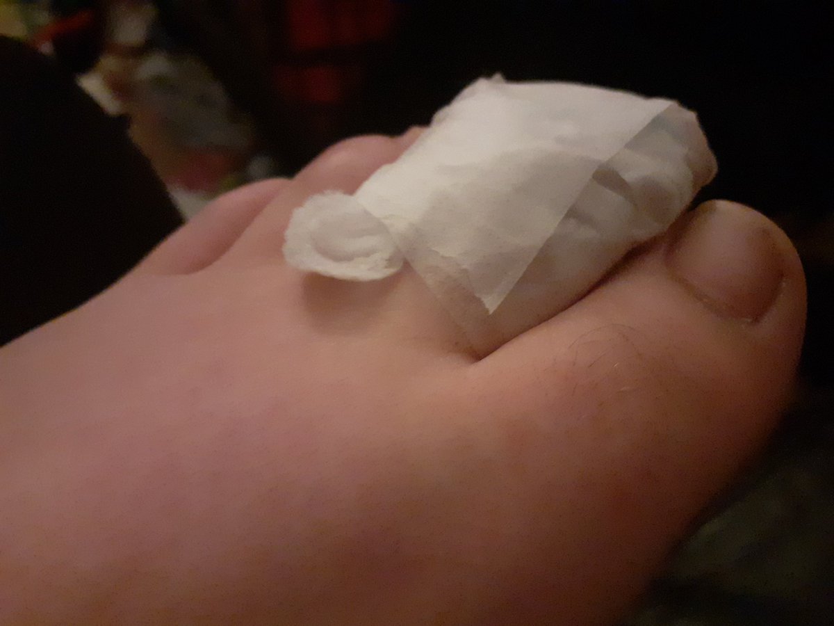 dancingcheyenn1's tweet photo. Dance injury lol😂 @TrinityAcademyL https://t.co/nWcj0wSbgm