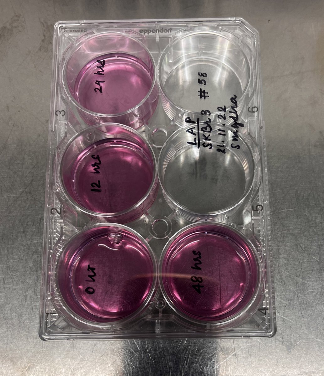 SnigdhaSarthak's tweet photo. The biggest #L is setting up an experiment knowing v well that it’s bound to fail.

#fails #labdiaries #research #CancerResearch #badjoke https://t.co/efajibdPeN