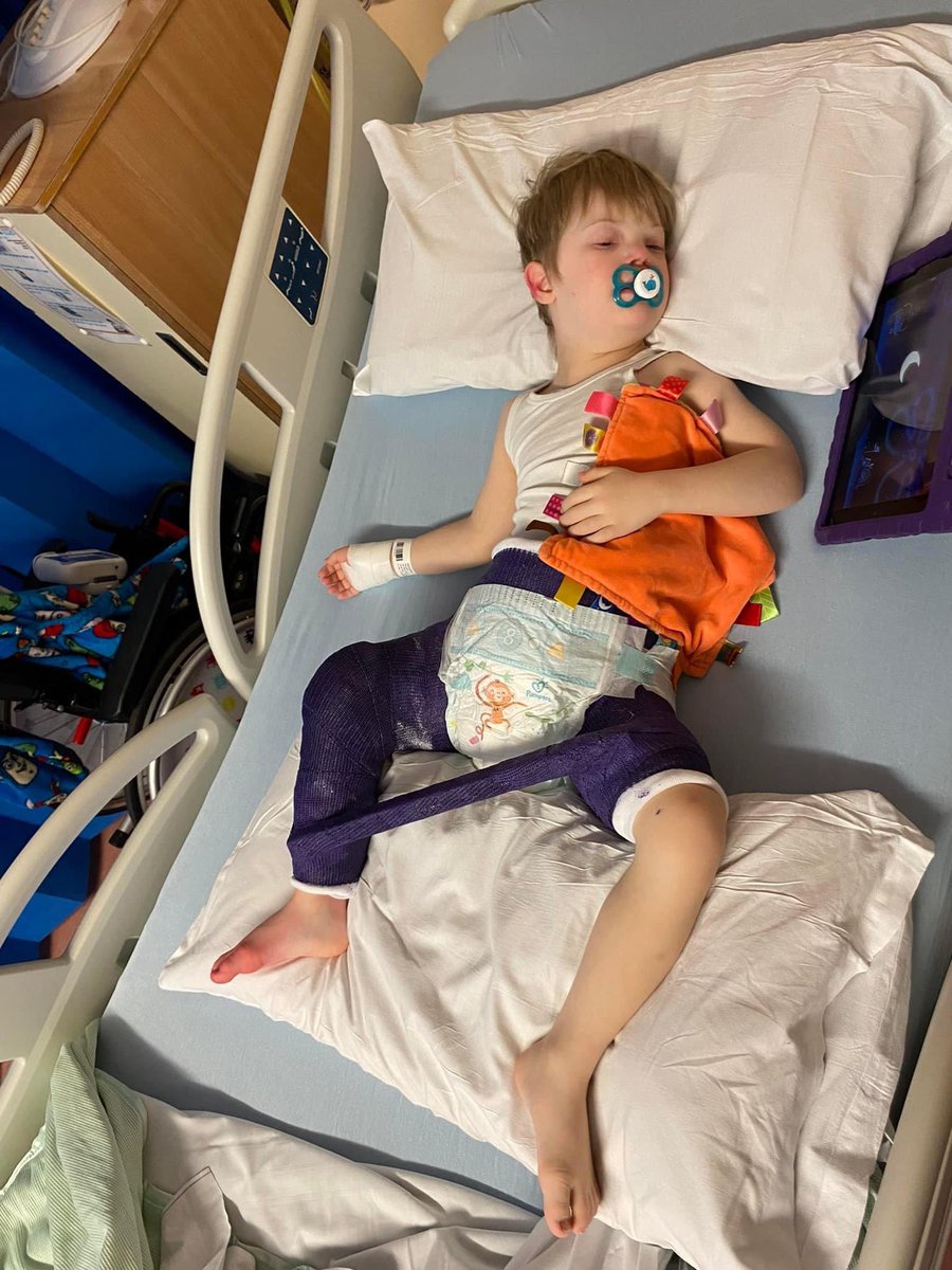 carollesley66's tweet photo. Part one done 💪🏼#downsyndromerocks #hipcast #grandson 🥰 https://t.co/nvho89sSxo