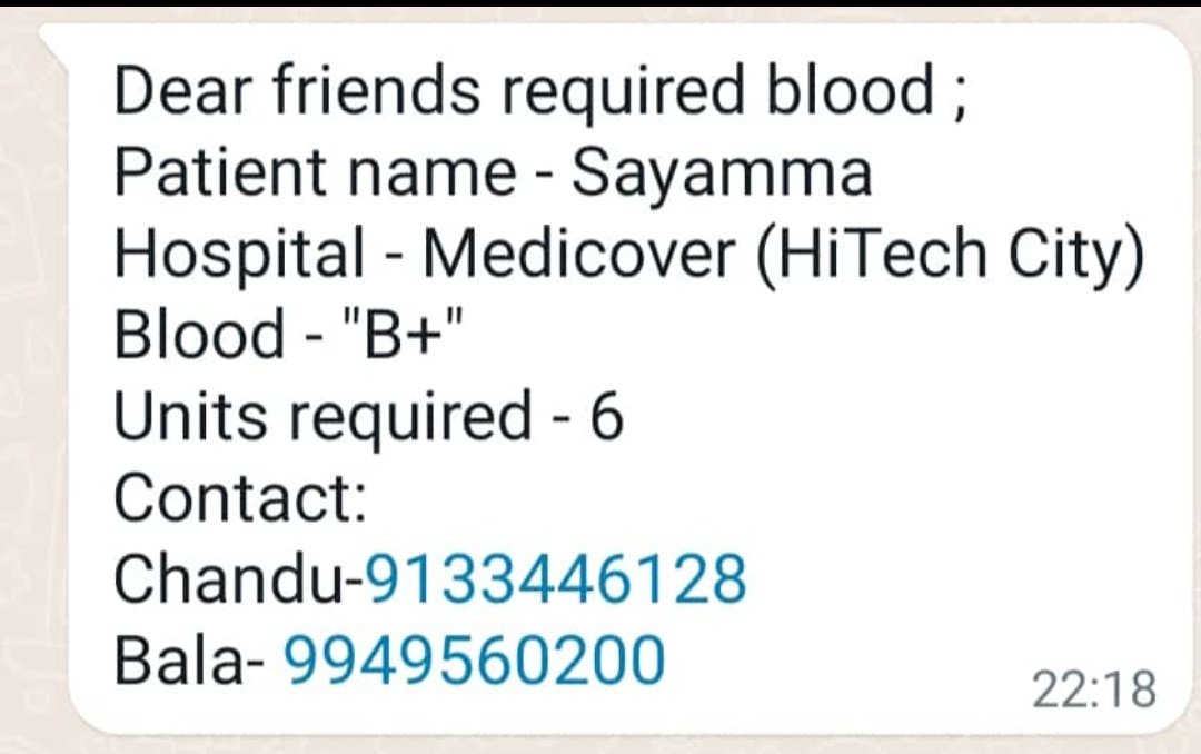 scarydankvader's tweet photo. @BhavaniPonnala @charan_tweetz @FAHIMUDDINSID please help Bala in this https://t.co/V1nchUIT9g