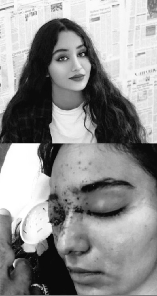 توهم دیدی، که این دژخیمانِ خونخوار به قتلِ تبسم  آلوده اند:)؟
#غزل_رنجکش 
#مهسا_امینی