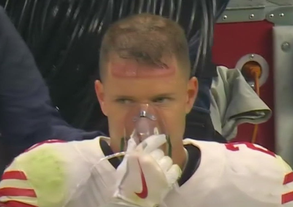 NFLonCBS's tweet photo. Christian McCaffrey's helmet is leaving quite the mark 😮 https://t.co/CtkuRmhvOg