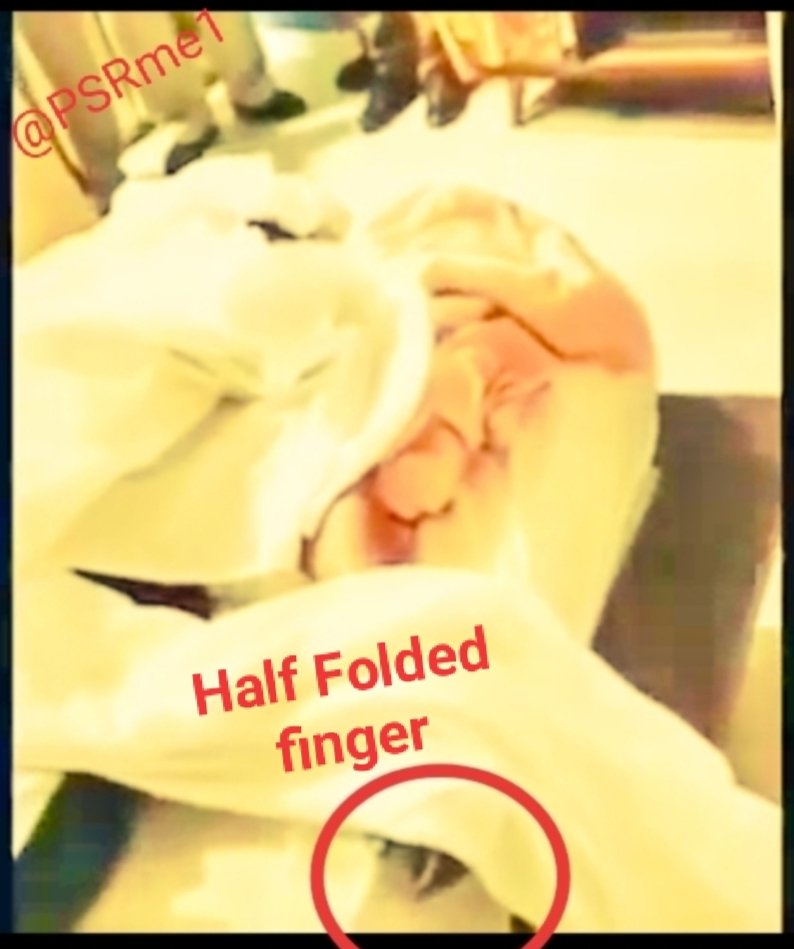 TrueColoursOnly's tweet photo. 14/25
should be used for demonstrating early bruises.)

19. How many bodies were allowed by Cooper in its boundary/radius by 3 ambulances not mentioned.

20. No traces of pomegranate juice &amp; coconut water found in Sushant Singh's stomach or bladder.

Justice4SSR Our Only Goal https://t.co/g6kr1h8M3k
