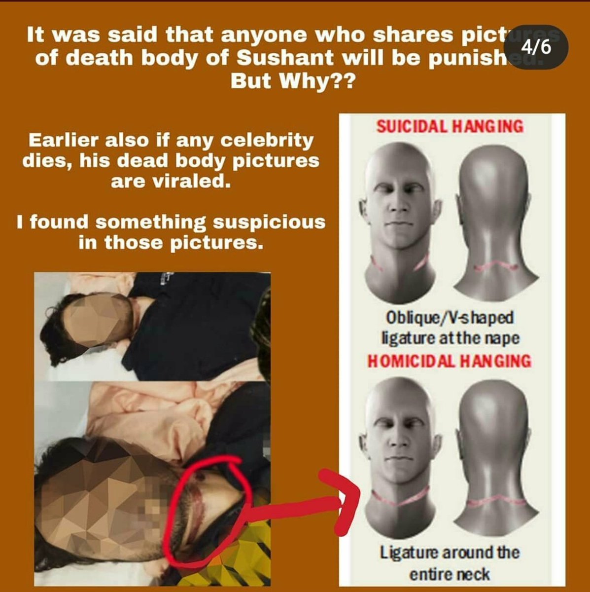 TrueColoursOnly's tweet photo. 19/25
not ruled out any aspect till date?)🤔

🙏 Let's logically understand
👇
✓. A homicide bruise crystal clearly shows the following 
👇
1.  A bruise produced by a weapon will be of the shape corrosponding to the weapon of assault.

Justice4SSR Our Only Goal https://t.co/io6dcs3tv2