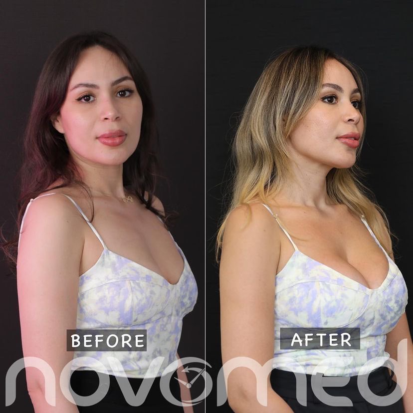 Novomed tweet media