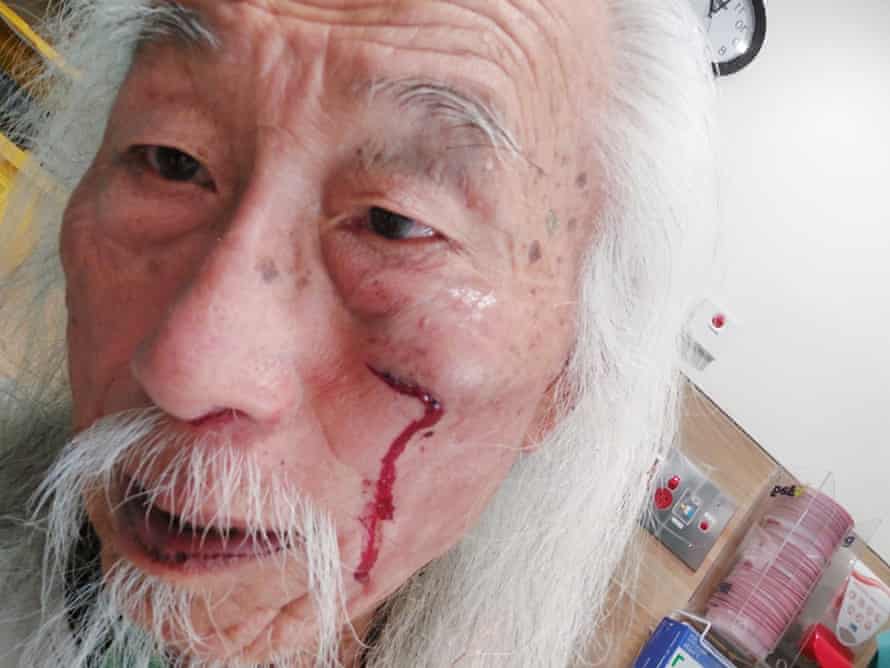 StrewthQueen's tweet photo. All you free speech advocates better spark up about the violent arrest of 78yo Danny Lim, for the crime of wearing a billboard - which has already been ruled by a judge as "not criminally offensive"

Police deliberately tripped him to headplant on the tiled floor, now in hospital https://t.co/DOG4VwqF0h