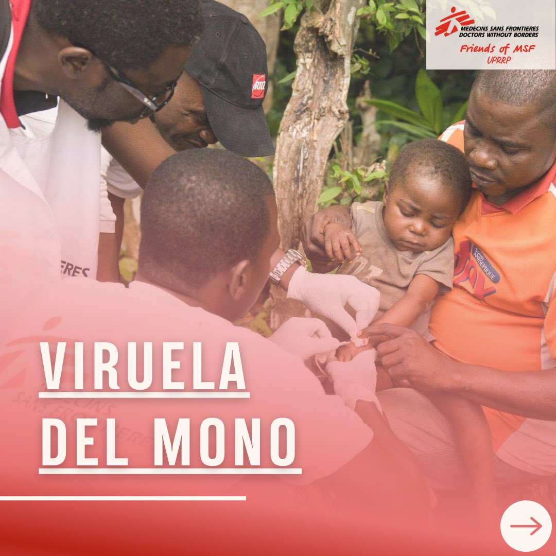 FriendsMSFuprrp's tweet photo. Conoce sobre la 𝗩𝗶𝗿𝘂𝗲𝗹𝗮 𝗱𝗲𝗹 𝗠𝗼𝗻𝗼, sus síntomas, prevención y tratamiento, y un poco sobre su surgimiento.🦠

#MSF #FoMSFUPRRP #FoMSF #Monkeypox #VirueladelMono https://t.co/0Eem2EYcU3