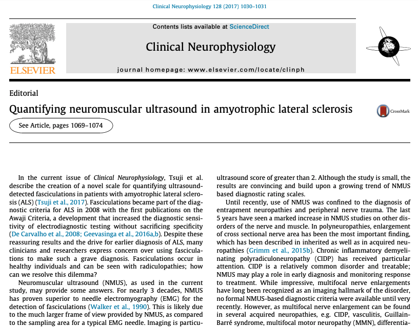 [Neuromuscular ultrasound in ALS] Hobson-Webb and Grimm suggested that the biggest benefit of neuromuscular ultrasound would be improved diagnosis in very early stages of disease, when distinction of ALS and ALS mimics is essential.

doi.org/10.1016/j.clin…
#ALS #ClinicalNeuroph