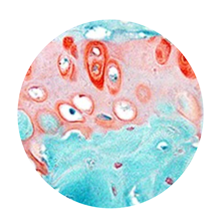 RheumJnl's tweet photo. #RheumOff Round Two!
1️⃣ Safranin O–Fast Green and H&E staining of knee cartilage from DMM mice https://t.co/HsnIEGRILF by Liangliang Liu et al
2️⃣ (Immuno-)histological analysis of parotid gland tissue from pSS patient https://t.co/YCeFEbTJTz by Esther Mossel et al
Continued👇 https://t.co/MQOVlwf18P