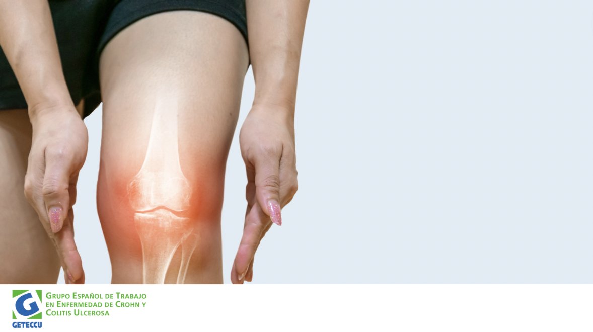 🦴 En los #pacientes en tratamiento con corticoides se aconseja evitar los deportes y ejercicios físicos que sobrecarguen las articulaciones y las estructuras óseas para prevenir complicaciones.