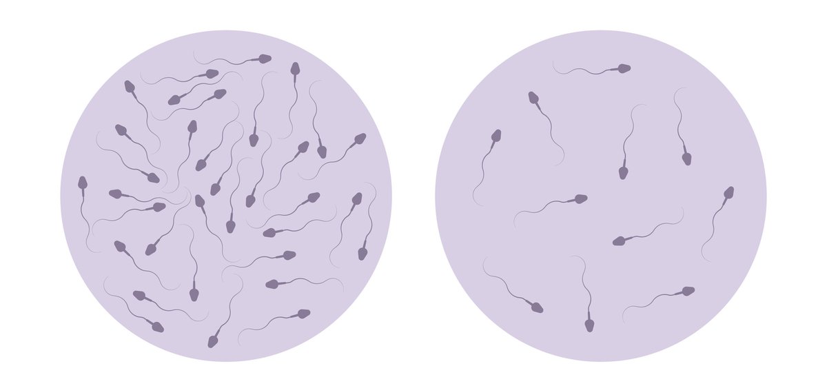 FPFabrizioPhD's tweet photo. Il calo del numero di spermatozoi è diventato più ripido dal 2000 (e continua a peggiorare): ecco perché è grande problema di salute pubblica. 1/n https://t.co/oHFqBrPWWm