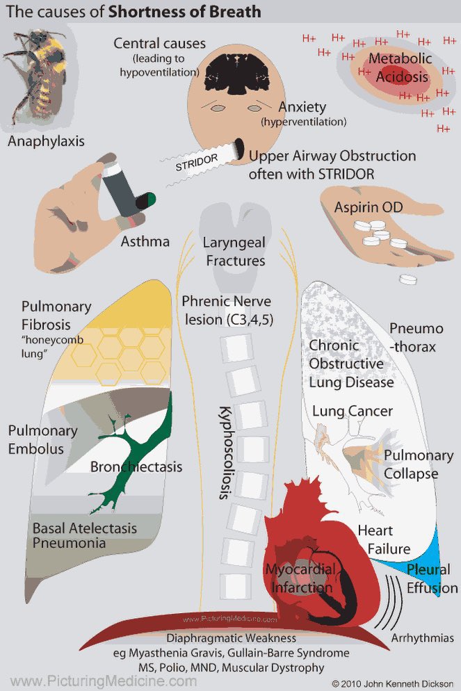 Medical_MD1's tweet photo. Great Recap 🤩

Differential Diagnosis &amp; How to approach Dyspnoea 😮‍💨

. https://t.co/b9mfARFMGX