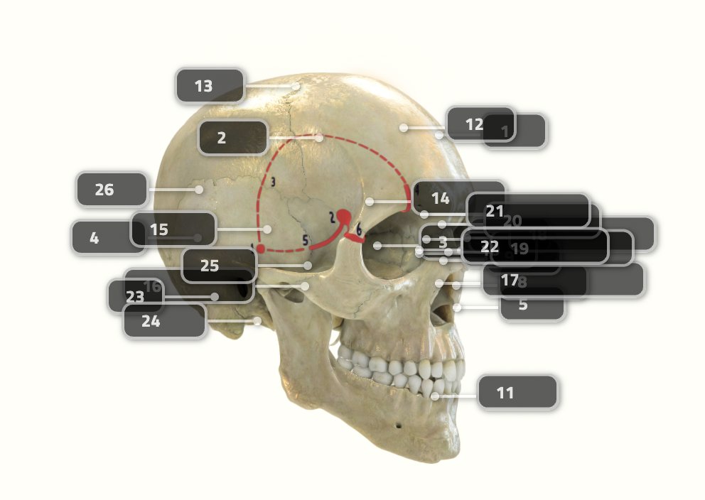 #ONSNew #NeurosurgicalAtlasSeries Frontotemporal-Orbitozygomatic Approach and Its Variants: Technical Nuances and Video Illustration bit.ly/3tGyOKZ by <a href="/telahmadieh/">Tarek Y. El Ahmadieh, MD</a> et al <a href="/LLUHealth/">Loma Linda U. Health</a> <a href="/haboualshaar/">Hussam Abou-Al-Shaar</a> <a href="/AaronCohenGadol/">Aaron Cohen-Gadol, MD</a> <a href="/drjfm_stanford/">DrJFM - Juan C. Fernandez-Miranda MD -</a> <a href="/CNS_Update/">CNS</a> <a href="/DKondziolkaCNS/">Douglas Kondziolka</a>