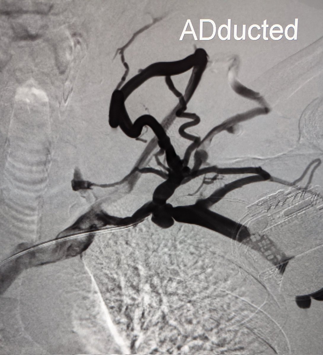 Mark Lessne, MD tweet media