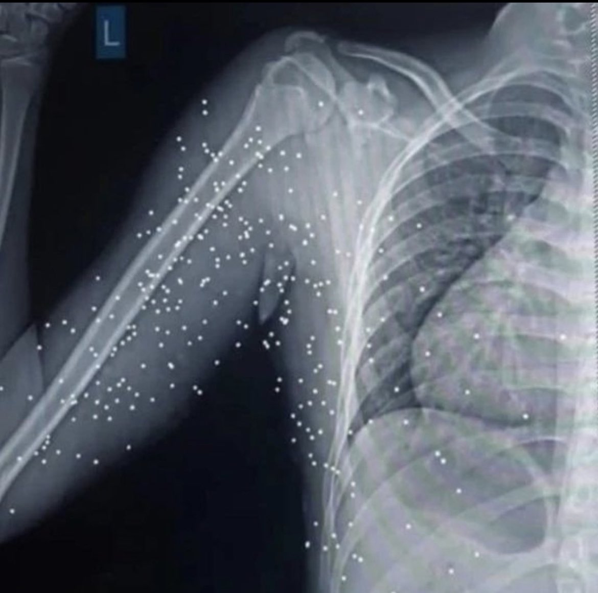 Der Körper des 14jährigen Ilya Rezaei aus Mahallat (Zentraliran). #IranRevolution