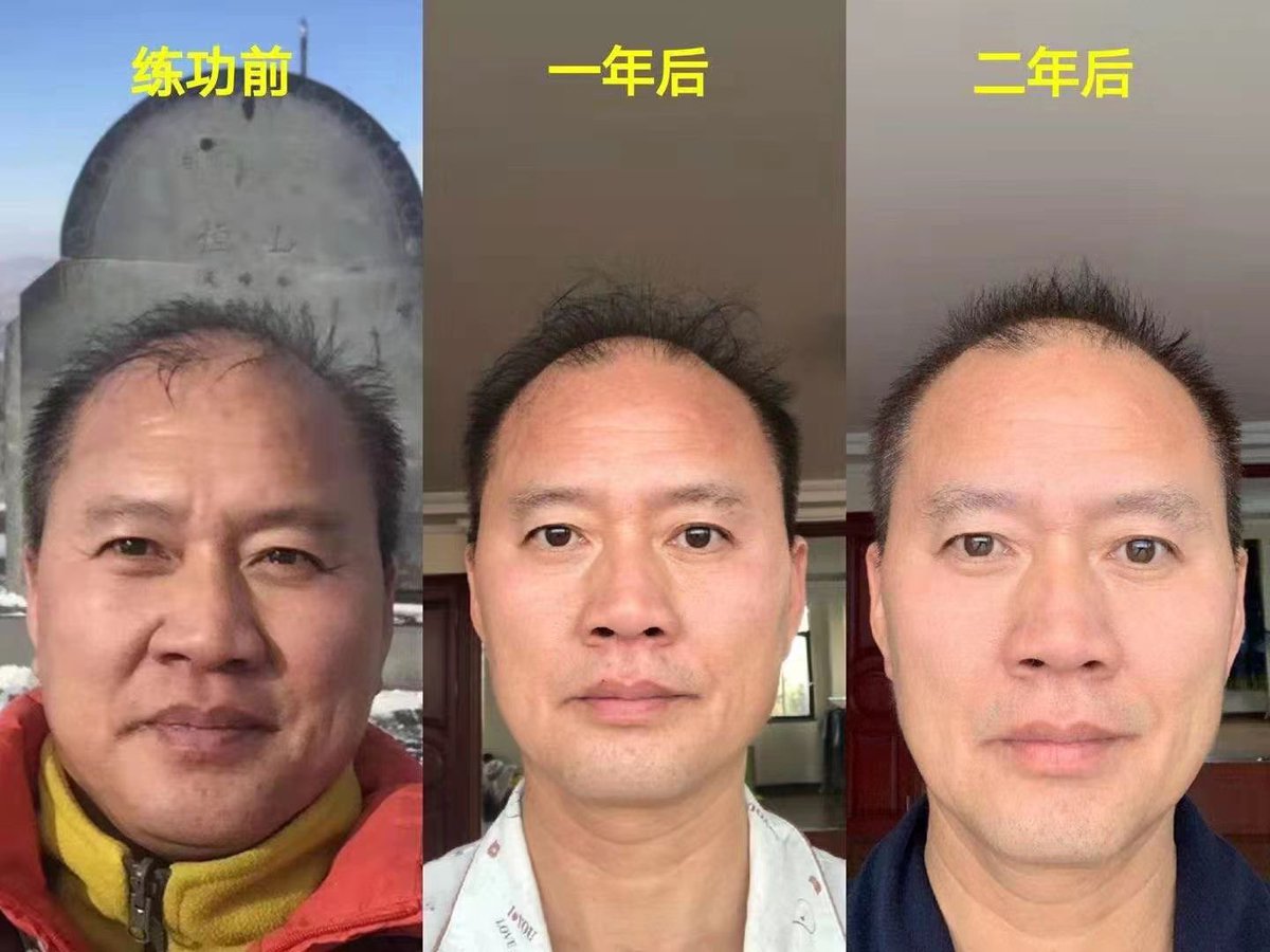 daomi413's tweet photo. 【洗髓功根部垂吊的功效】
1.洗髓开肾：通过下体垂吊，拉住腹股沟，拉通神经络，把肾里的污浊通过新陈代谢的方式，排出体外，列如：大小便、出汗等。
2.恢复元气：通过吐纳、固精等方法让自己快速恢复肾气，保持肾活力。达到精满 https://t.co/I5jSCnx5VD