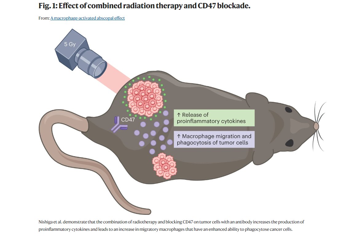 New in <a href="/NatureCancer/">Nature Cancer</a> from <a href="/MSKCancerCenter/">Memorial Sloan Kettering Cancer Center</a> Drs Chris Barker and <a href="/xrtGenomics/">Nadeem Riaz</a>: Combining #radiotherapy with activation of macrophages yields potent, abscopal effects in mouse tumor models... this may be ready for translation into early clinical trials.
📰nature.com/articles/s4301…