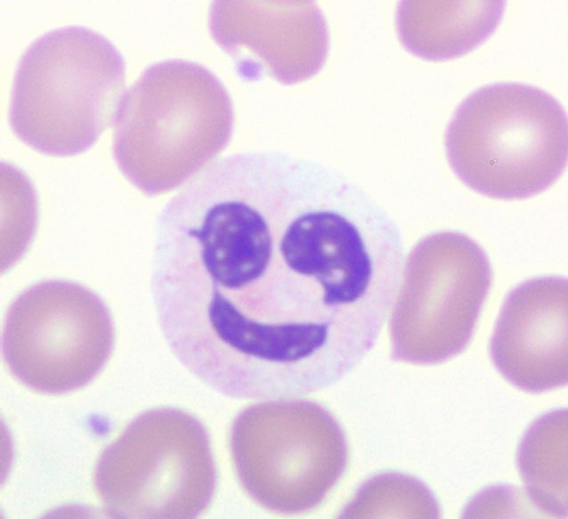 cd45dim's tweet image. Finally at the bottom of a big pile of marrows, just in time for a little vacation!  Current mood: