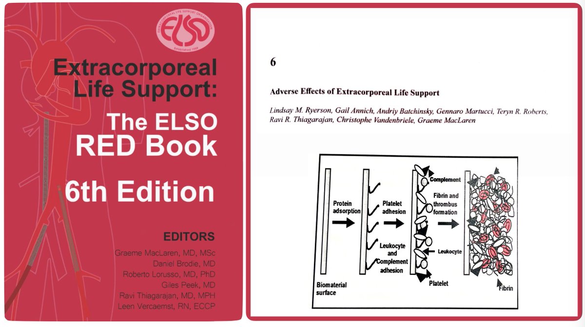 ELSOOrg's tweet photo. Adverse effects of #extracorporeal life support
📕 pathophysiology of blood/biomaterial surface interaction 
📕 #ECMO initiation: coagulation activation &amp; inflammatory response
📕 other adverse effects
Read all in chapter 6 of 6th ed of ELSO Red Book
🛒 📕
https://t.co/EeXubFXFjx https://t.co/bqwnfQN0c6