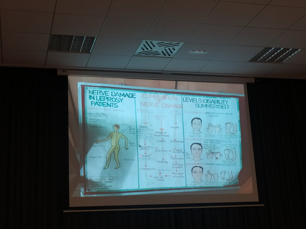 dermalawi's tweet photo. Hoy Violeta Bagase nos ha hablado de lesiones neurológicas de la lepra y de sus experiencias en proyectos de cooperación en España, India, Brasil y Camerún. https://t.co/EAatcdjvbk